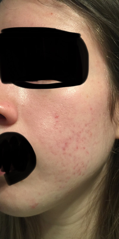 BE306E07-B9F9-47F6-AB84-A8AC18CB6C15