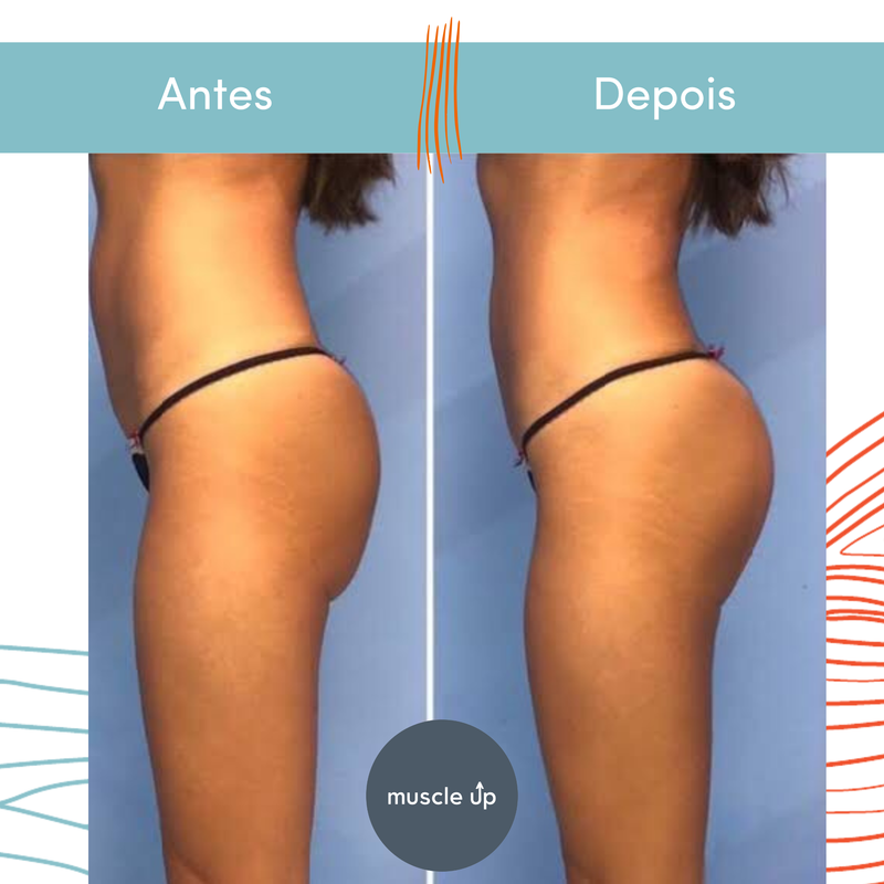 Projeto 1