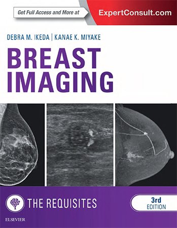 Breast Imaging, 3rd Edition
