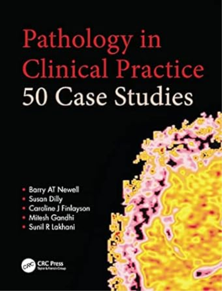 Pathology in Clinical Practice: 50 Case Studies