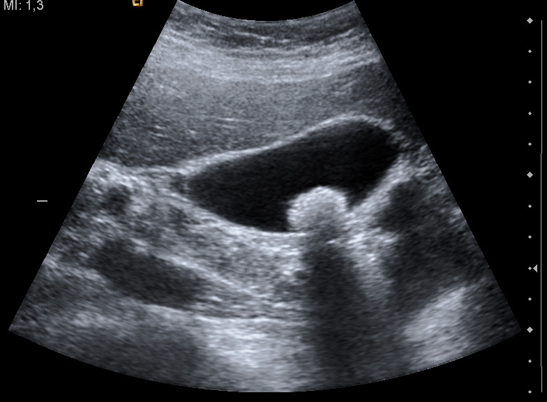 Gastroenterology question 6 image