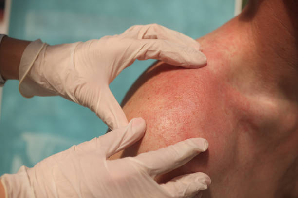 {allergy doctor port richey fl|Kratz Allergy|allergist spring hill fl|allergy specialist odessa fl|asthma treatment port richey fl|allergy testing spring hill fl|allergy shots port richey fl|eczema treatment odessa fl|sinus treatment spring hill fl|food allergy doctor port richey fl|immunologist port richey fl}