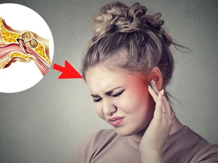 Pulsierender Tinnitus