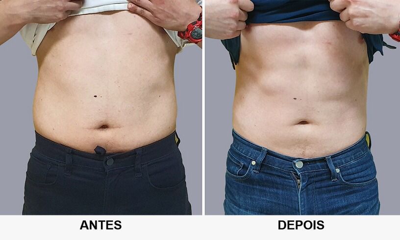 Projeto 12