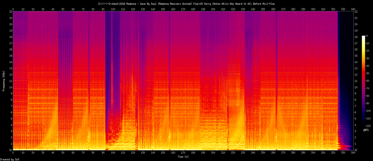 03 Sorry (Anton Aklin Has Heard It All Before Mix).flac