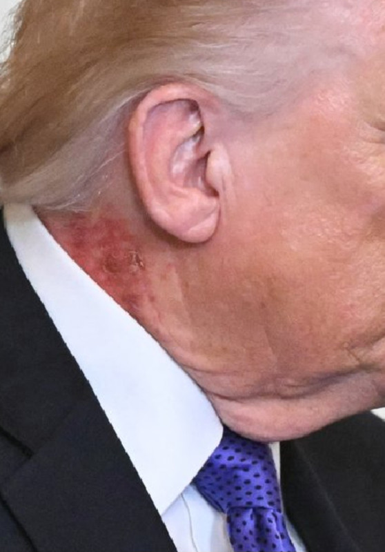 tis-but-a-scratch.jpg