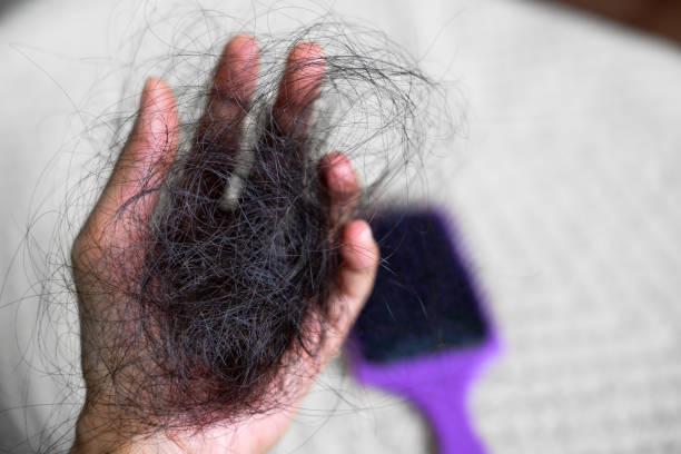 hair thinning