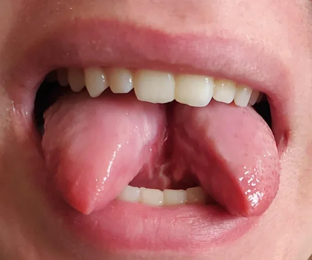 my-tongue-looks-split-instead-of-like-two-tongues-idk-how-v0-6bcvau8i7u4b1.webp