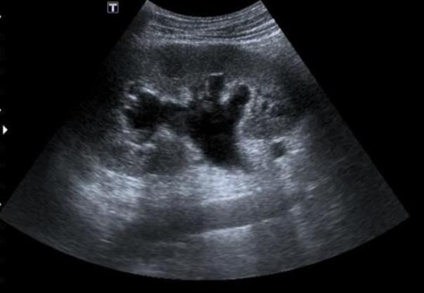 Urology question 3 image
