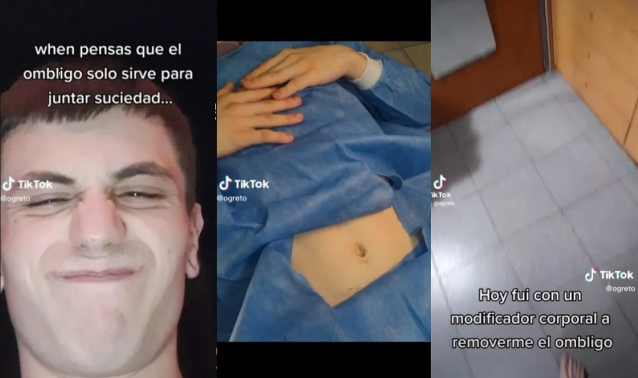 Hombre se quitó el ombligo solo porque acumula suciedad