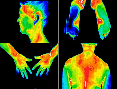 Pelvic floor patient receiving thermography imaging treatment at Pelvic Health Physical Therapy in Madison, NJ.