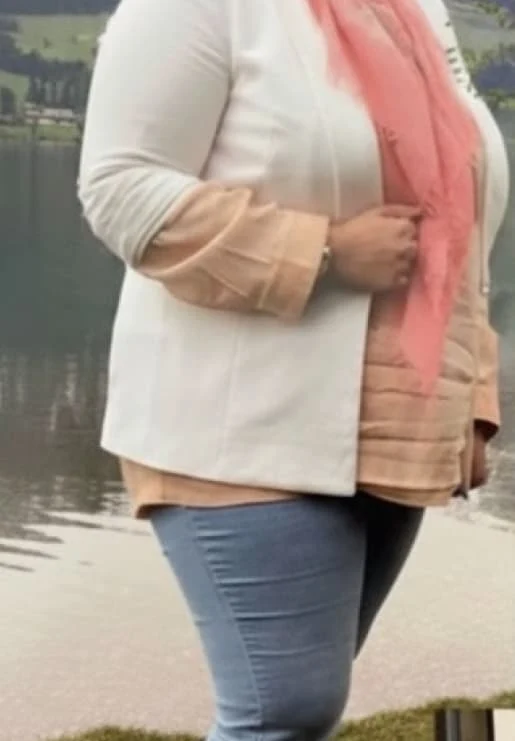 Man before his weight loss journey