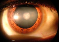 Ophthalmology question 1 image