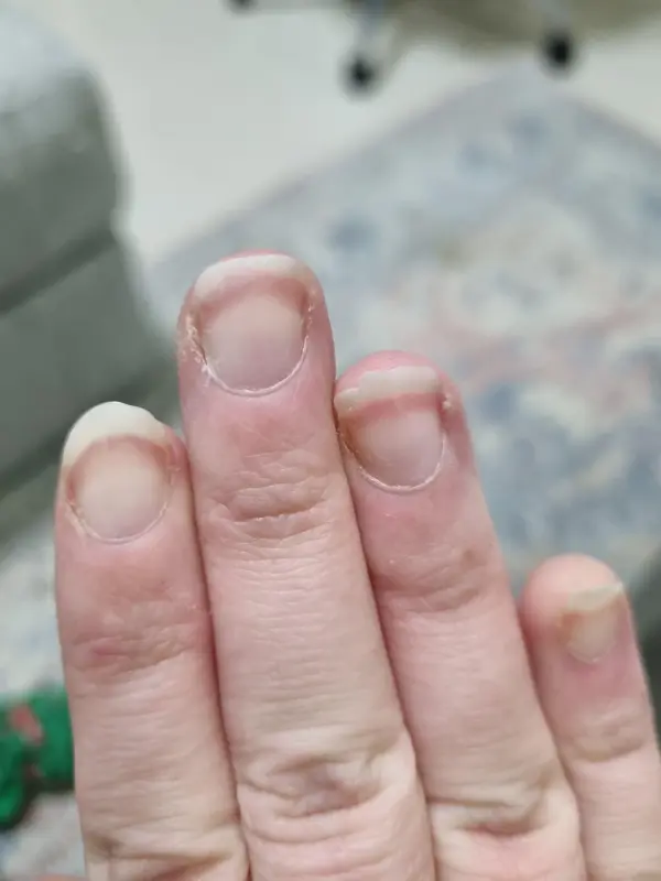 6-years-searching-for-diagnosis-just-found-multiple-v0-dccb9qnhxyod1