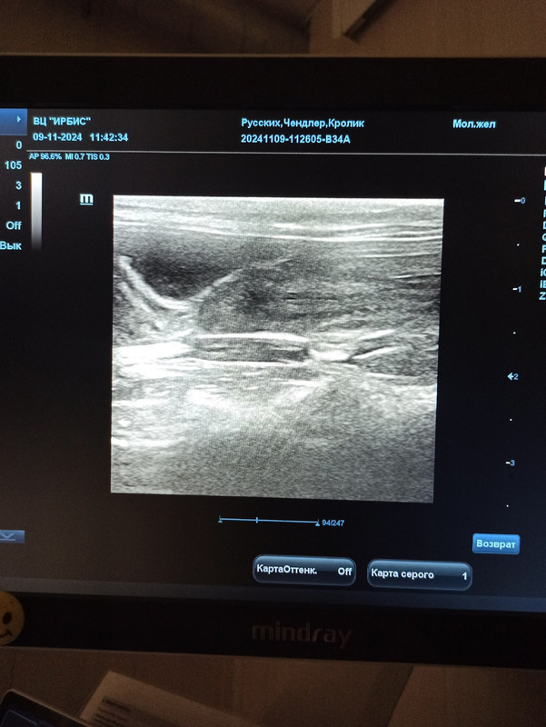 узи желудок