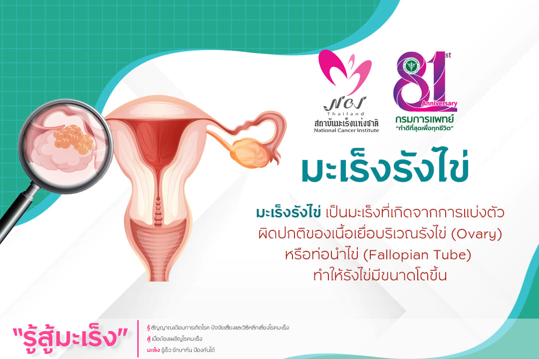 มะเร็งรังไข่