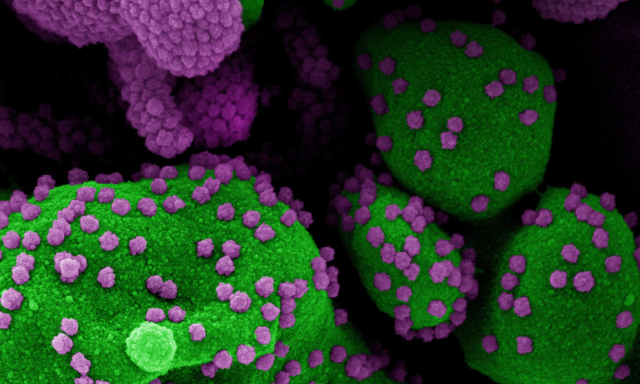 Vendrán más variantes de COVID-19 después del Ómicron