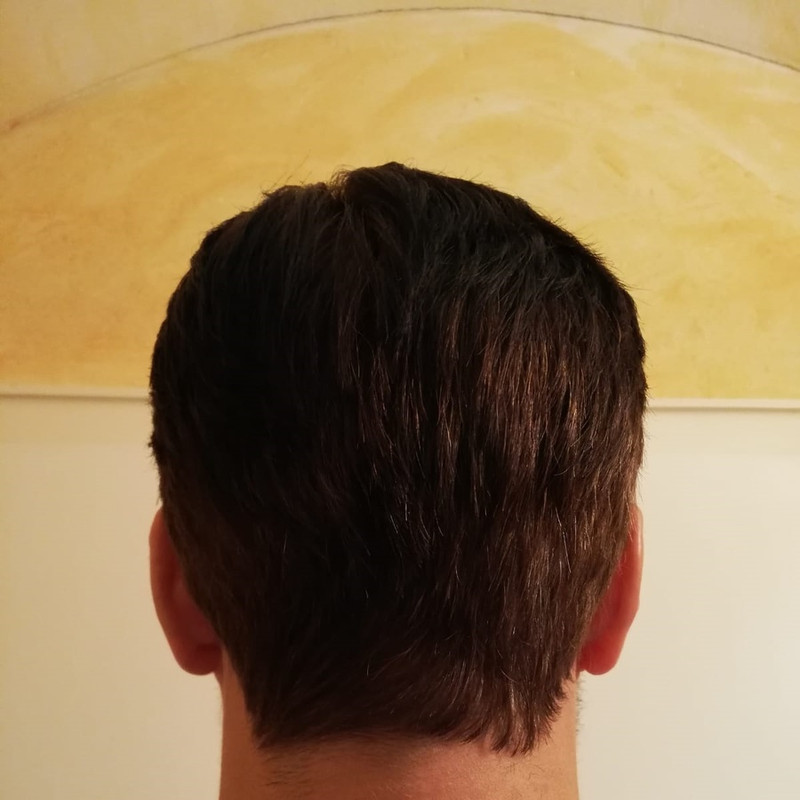 16 mesi 2001 grafts dense pack (6)