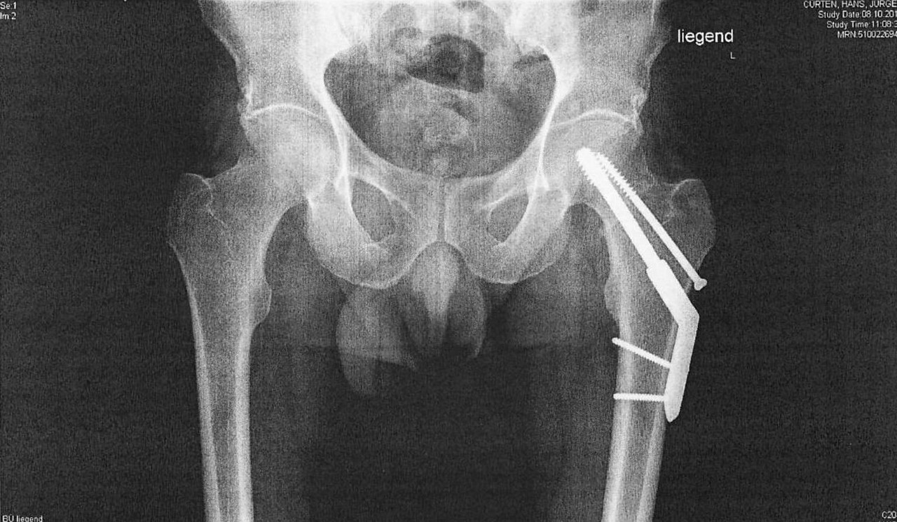Röntgenbild 20121008_Page_1_kopie