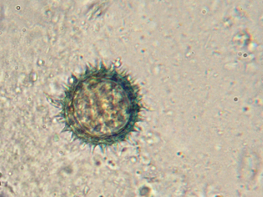 2018-12-27_0001_100Xy