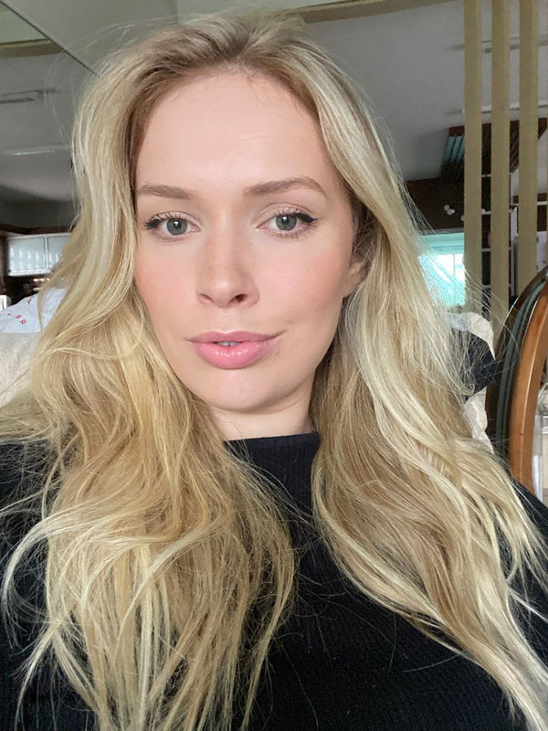 Antes e depois - resultado 3