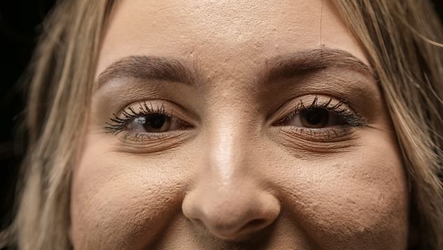 Why does my makeup look cakey, patchy, dry, and separate around the nose, cheeks, and eyes? 