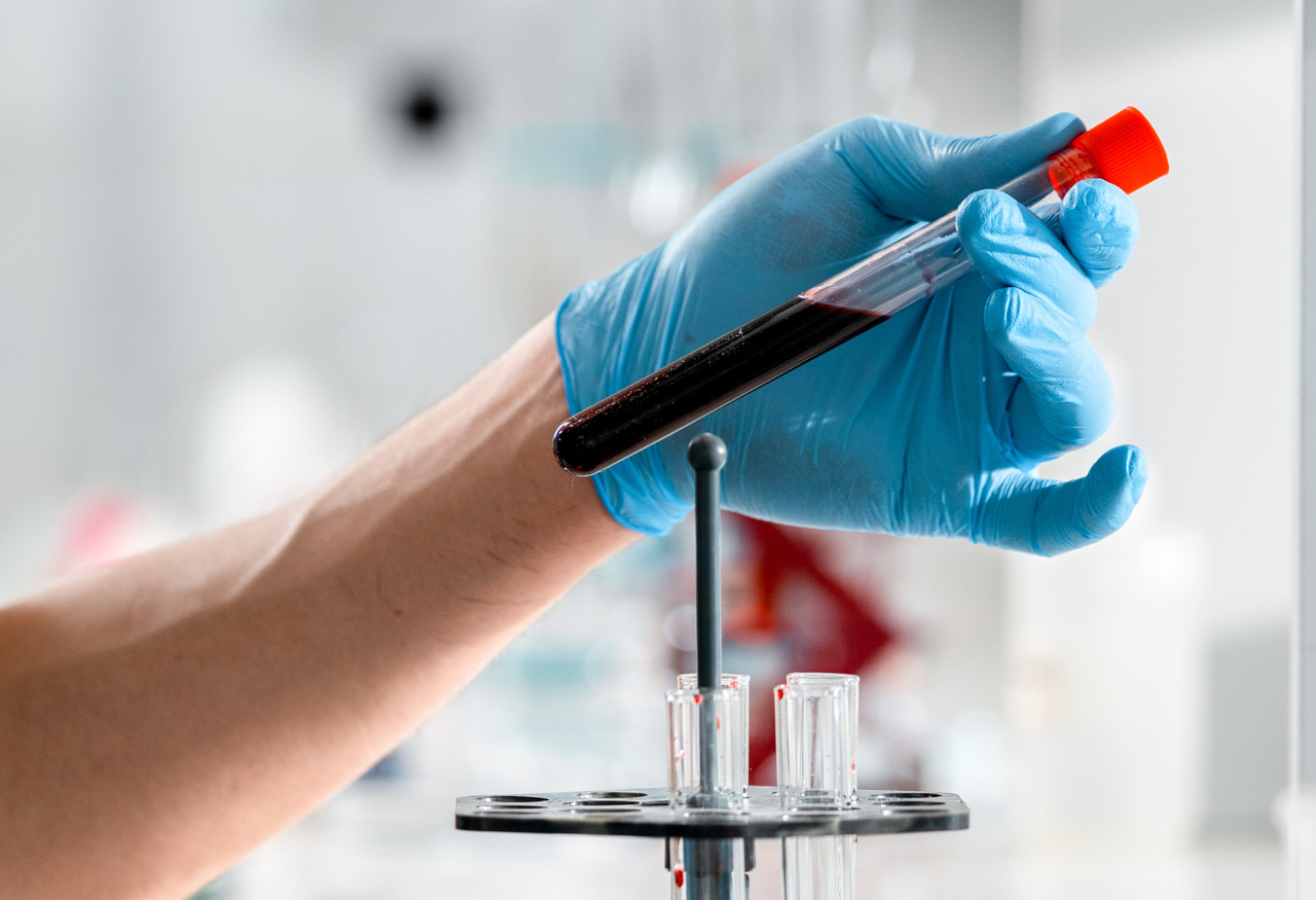 Pruebas_de_función_renal