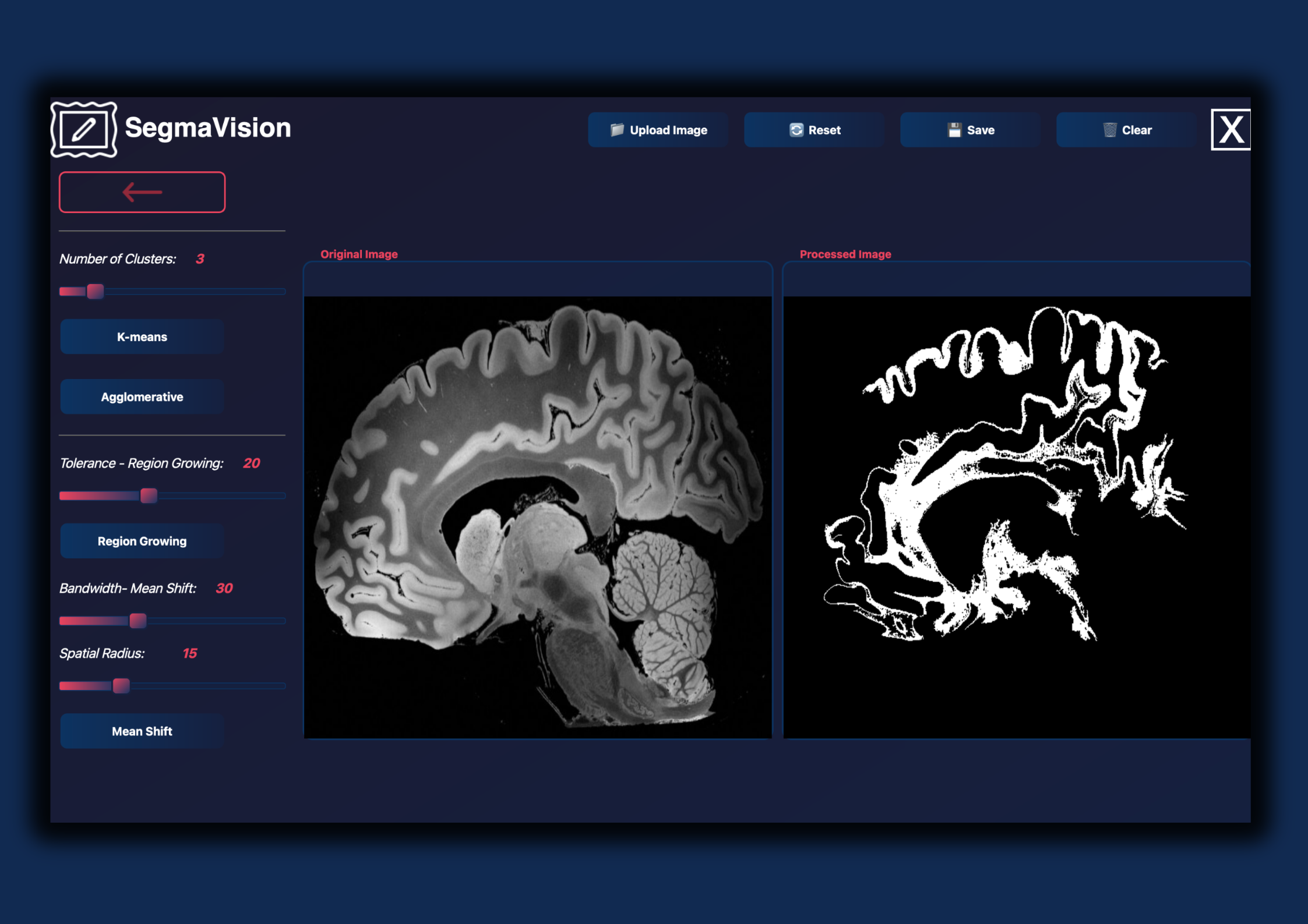 SigmaVision Overview