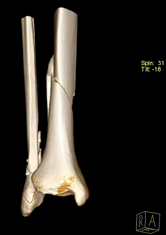 18 12 25 gleženj d vrt range 1 edit