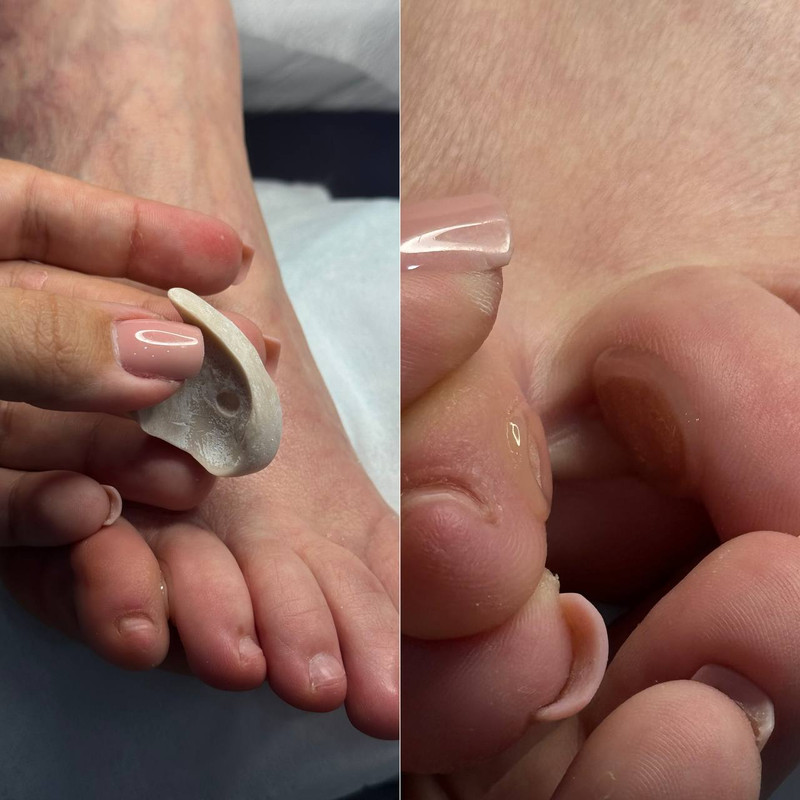 подология 7