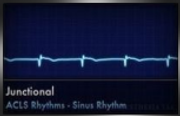 junctional sinus rhythm