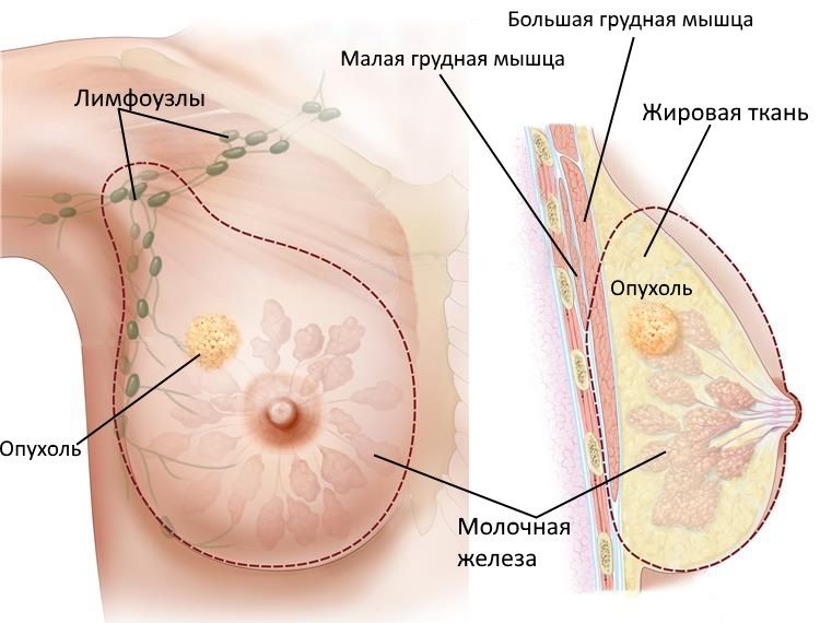 Молочная Железа У Женщин Фото