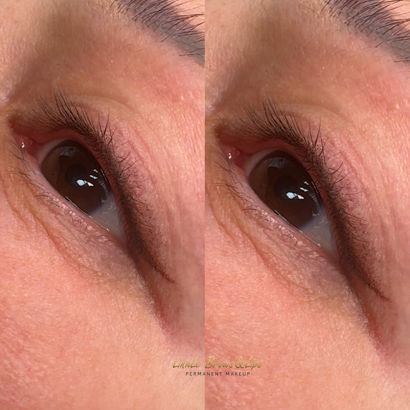 Eyebrow Enhancement Example 9