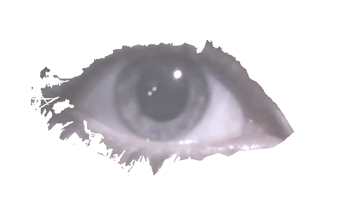 nystagmus eye movement nystagmus eye movement