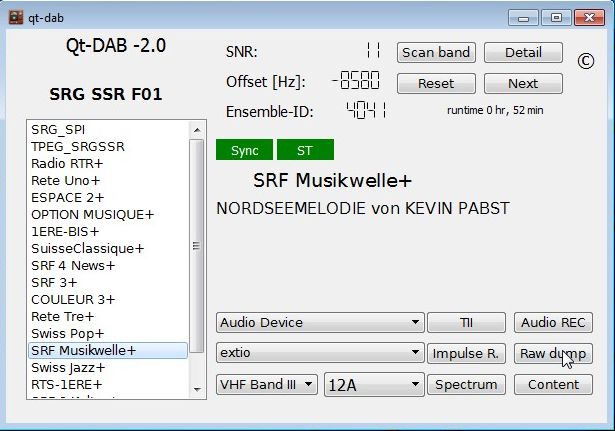 DAB+ SUISSE SRF-MUSIK