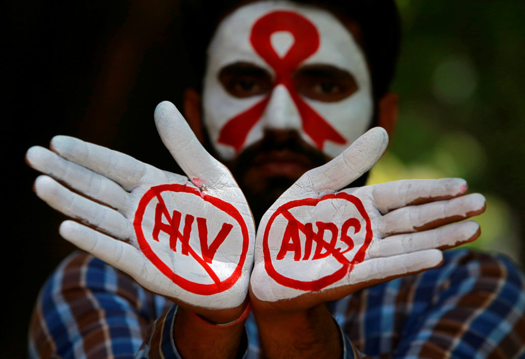 The Battle of HIV/AIDS Cure