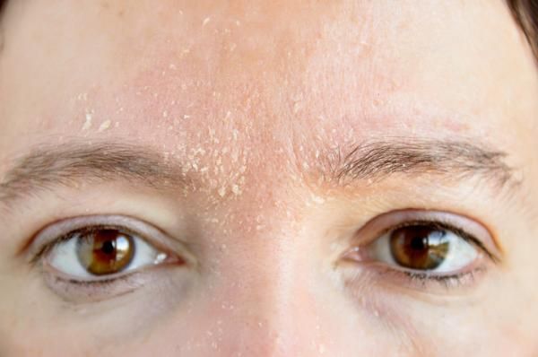 Cejas