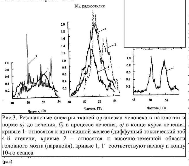https://i.postimg.cc/vTCY5JTP/podderzhanie-struktury-vodnogo-matriksa-vazhneyshiy-mehanizm-gomeostaticheskoy-regulyacii-v-zhivyh.jpg
