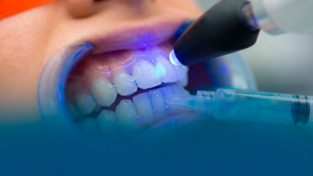 Dentística e Estética