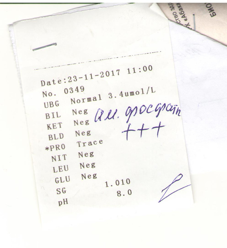 Анализ мочи_23.11.17