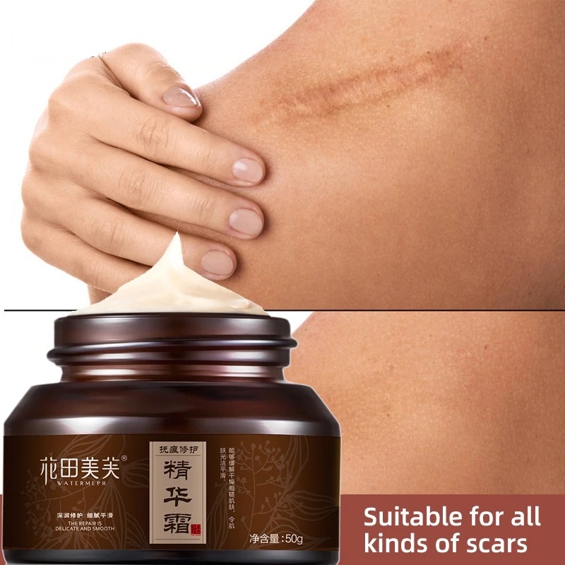 cream to remove surgery marks