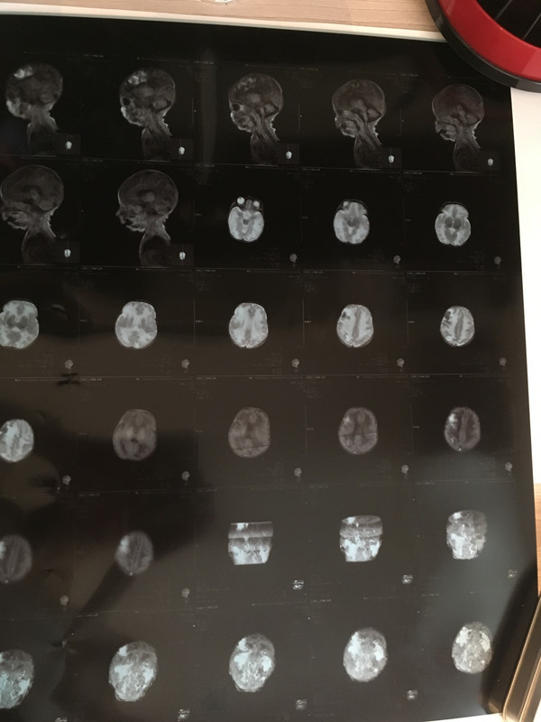 DCDFB38C-741E-4F74-8EED-DE63618F275B