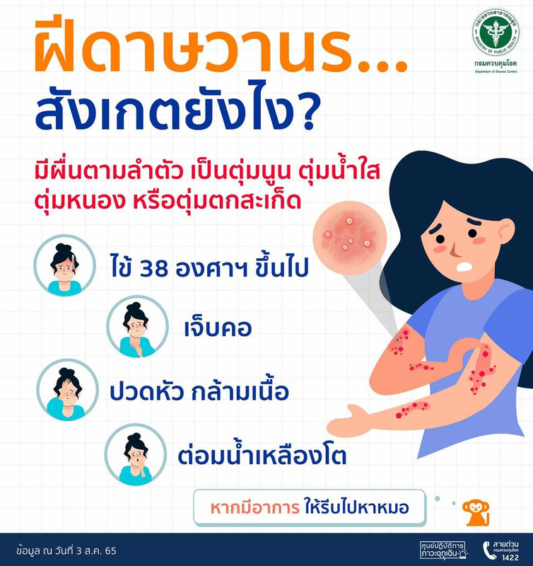 ฝีดาษวานร มีอาการยังไง สังเกตยังไง?