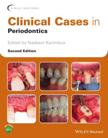 Clinical Cases in Periodontics, 2nd Edition