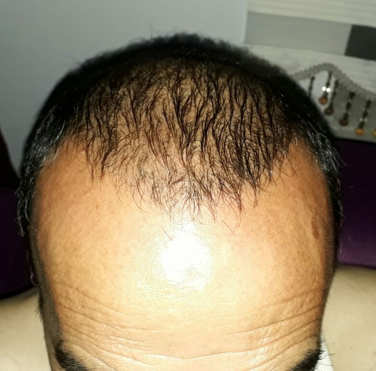 WhatsApp Image 2017-07-02 at 20.37.10