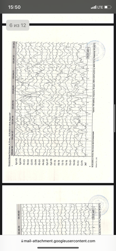 975FB292-18E4-437A-A545-BEC070BA4E44