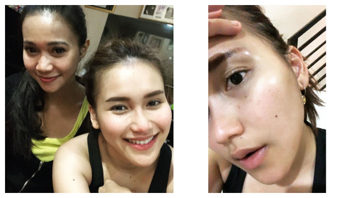 Ayu Ting Ting