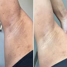 Resultado Brightening Serum