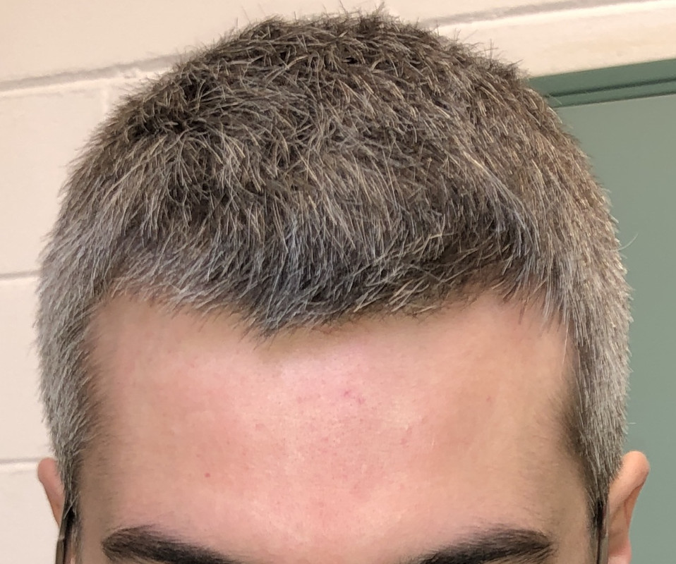 106ABEF4-7552-4BDC-8333-89E3940D4C71