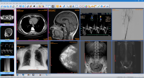 Sante DICOM Editor 3D 4.9.3